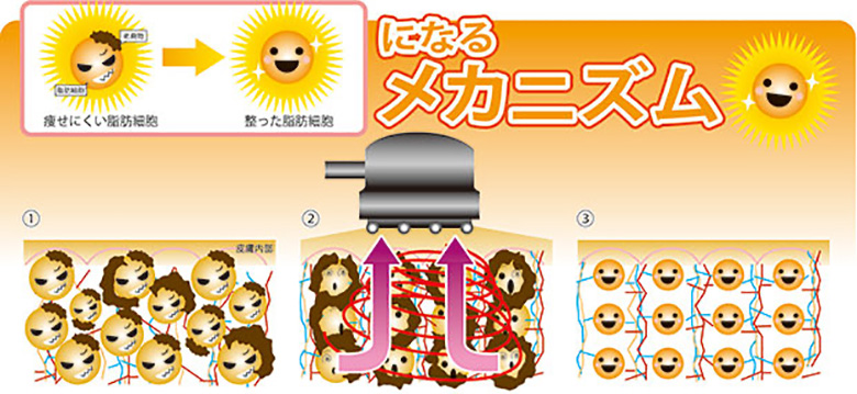 バクセルプロのメカニズム